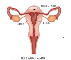 院网站-吉曼双宝——子宫的拯救者437