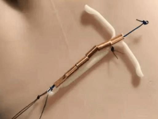 院网站-吉曼双宝——子宫的拯救者887